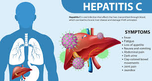 Hepatitis C ||know your status to avoid liver disease||