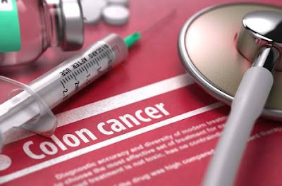 Colorectal Cancer Rates Are Rising Among Young White Adult – Colorectal Cancer Causes and Symptoms