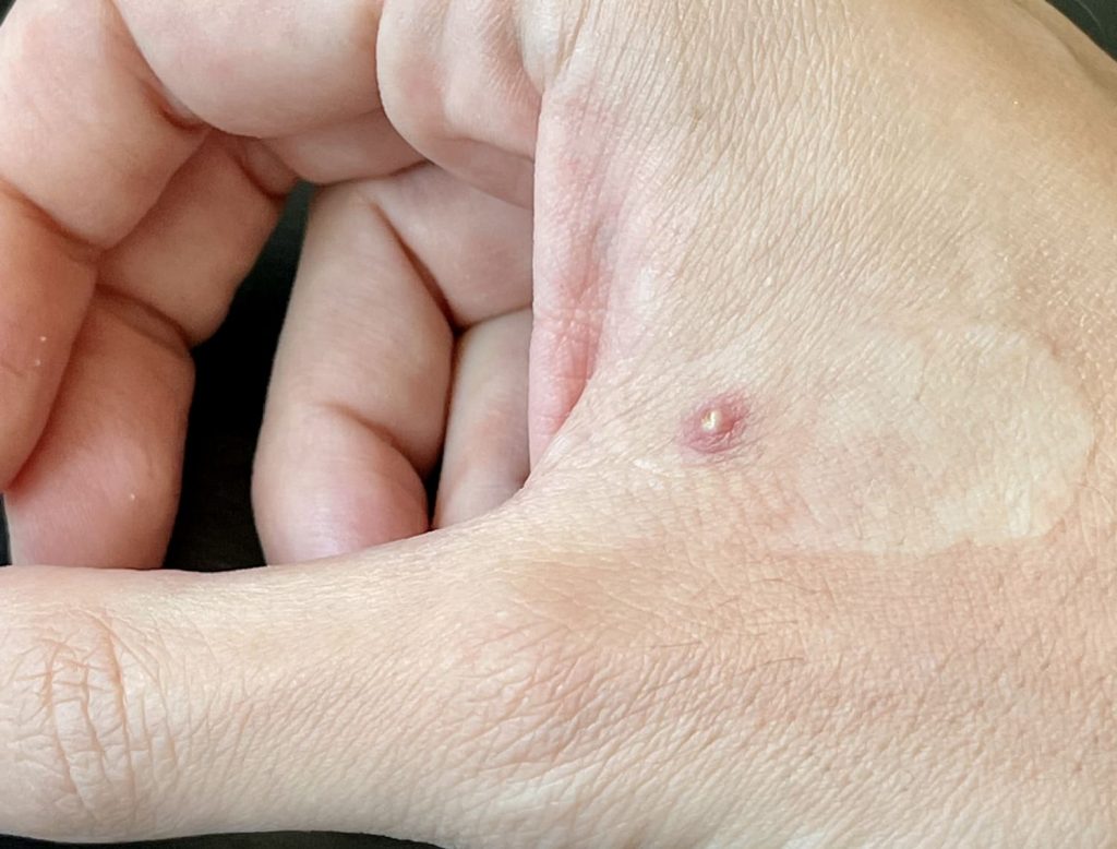 Jack Richards monkeypo